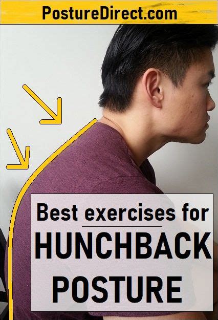 Hunchback Using a Computer 的图像结果