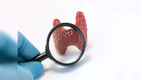 Hypothyroid,തൈറോയ്ഡ് ഉണ്ടോയെന്ന് സ്വയം കണ്ടെത്താന്‍ സിംപിള്‍ വഴി ...