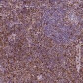 Monoclonal Anti-S100A4 antibody produced in mouse Prestige Antibodies ...