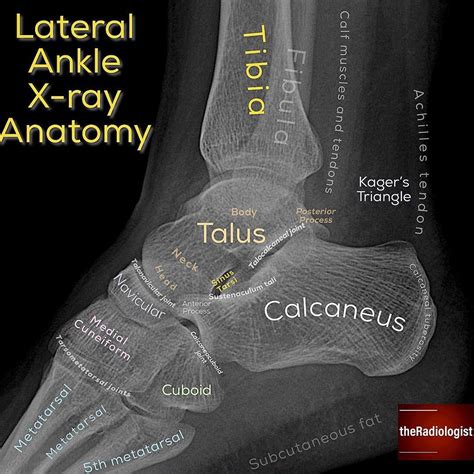 Xray Ankle