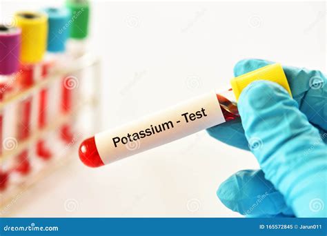 Blood Sample for Potassium Test Stock Image - Image of laboratory ...
