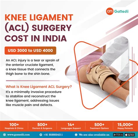 Arthroscopic Knee Surgery Cost In India at John Triche blog