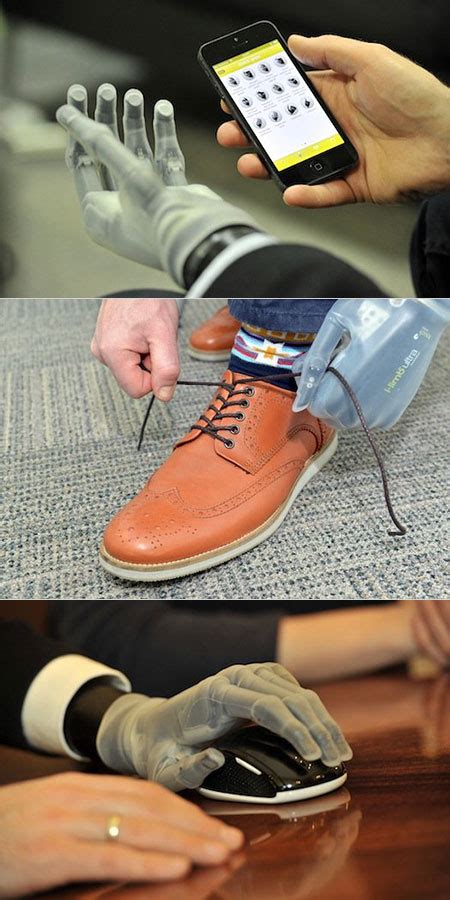 Image result for Bebionic Hand Users