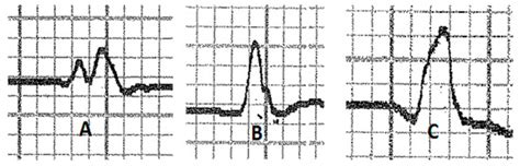 Electrocardiographic Reference Values in Clinically Healthy Lusitano Horses