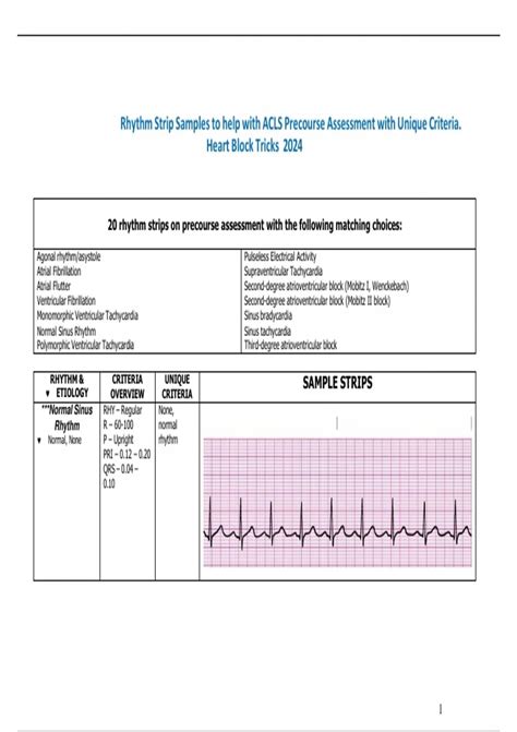 Rhythm Strip Samples to help with ACLS Precourse Assessment with Unique ...