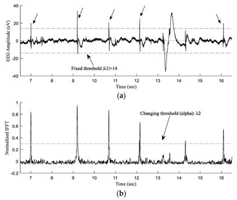 Sensors | Special Issue : Novel Approaches to EEG Signal Processing