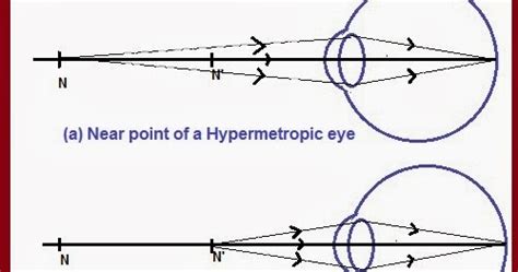 Image result for Class 10th Science Human Eye Chapter