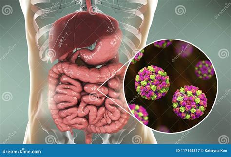 Noroviruses In Human Intestine Stock Illustration | CartoonDealer.com #117164875
