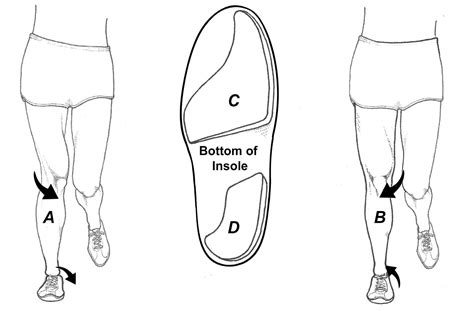 Valgus Feet Exercises at Toby Denison blog