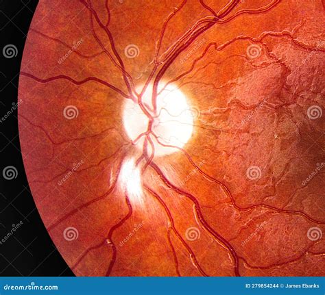 Blood Vessels In Human Eye. Stock Photo | CartoonDealer.com #279854244