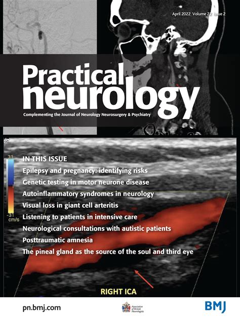 Post-traumatic amnesia | Practical Neurology