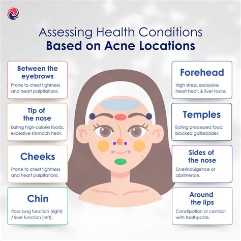 Location Of Pimples And Meaning