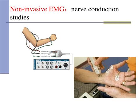 PPT - Electromyography (EMG) PowerPoint Presentation, free download - ID:1056729