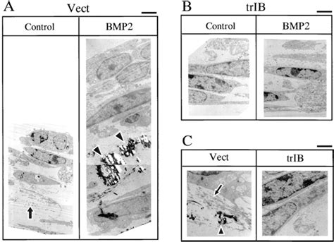 Microscopic Bone Matrix Figure 的图像结果