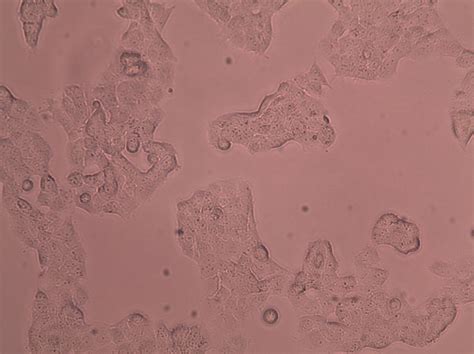 H69AR-H69AR细胞（耐药小细胞肺癌细胞）-H69AR-化工仪器网