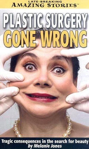Buy Plastic Surgery Gone Wrong: Tragic Consequences in the Search for ...