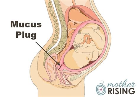 Mucus Plug Discharge Pieces