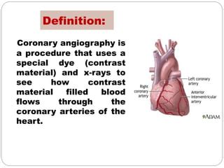 Image result for How Angiogram Is Done