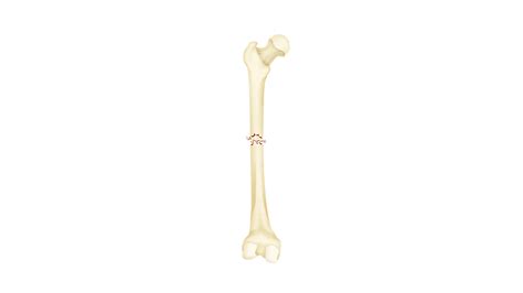 Fracture Types | DePuy Synthes