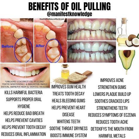 Pin by Joe Kangas on For health | Oil pulling benefits, Coconut oil pulling benefits, Oil pulling