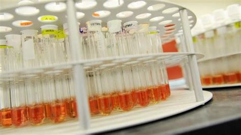 Biocon Ltd. Share Price Today | NS BION Stock - Investing.com India