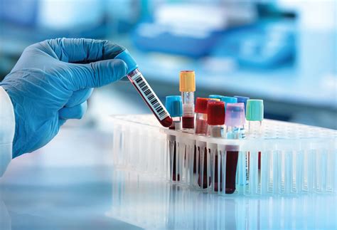 Northwell Labs at Syosset - Northwell Health Labs | Northwell Health