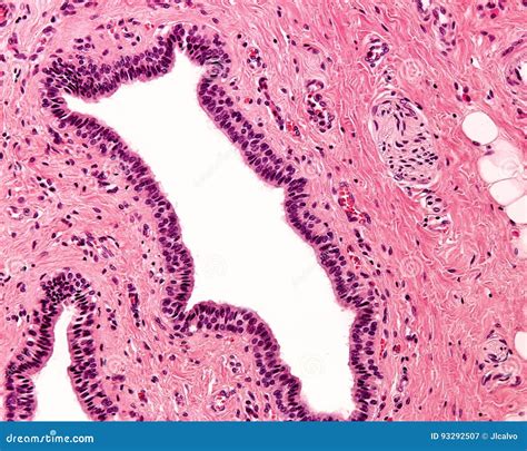 Stratified Squamous Epithelium Keratinized 400x