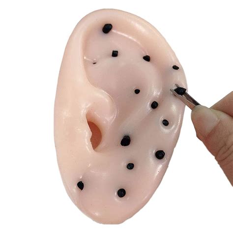 Pimple In Ear