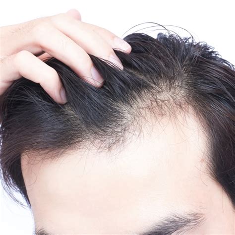 Y-Cell PRP Hair Regrowth Treatment Solutions in Nagercoil