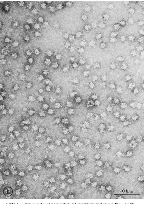 Ribosomes Microscope