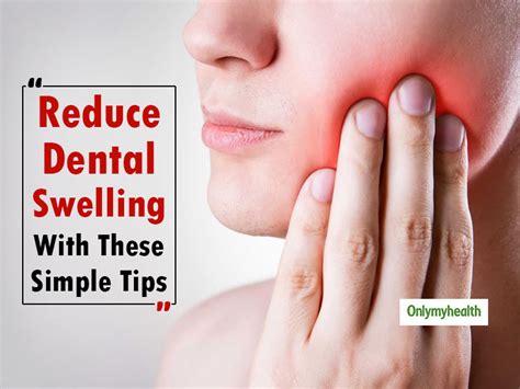 Just Had A Dental Surgery? These Tips Can Help Reduce Swelling Post ...