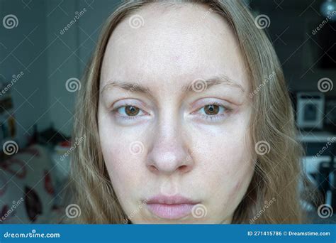 Round Face Plastic Surgery at Cecil Flaherty blog