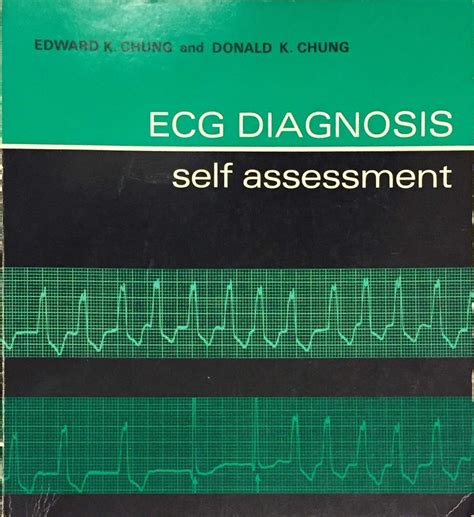 Buy Electrocardiogram Diagnosis: v. 1: A Self Assessment ...