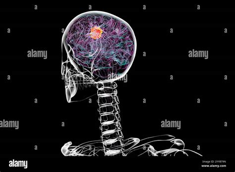 Computer Vision for Tumour 的图像结果