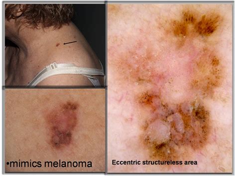 Image result for Chaos Algorithm