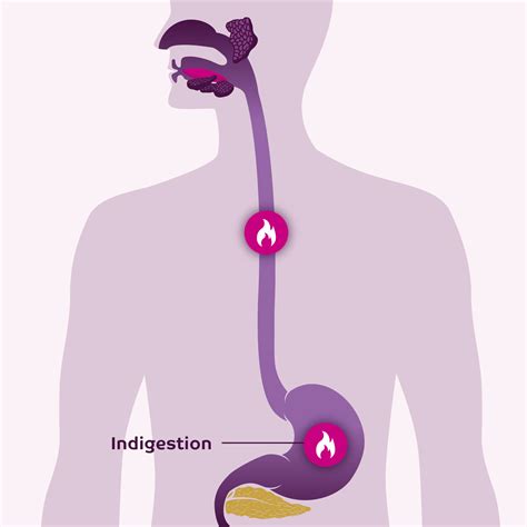 Indigestion Guide: Symptoms, Causes and Treatment