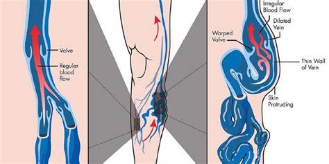 Special Ayurvedic Treatment on Cancer and Varicose Veins, Skin diseases ...