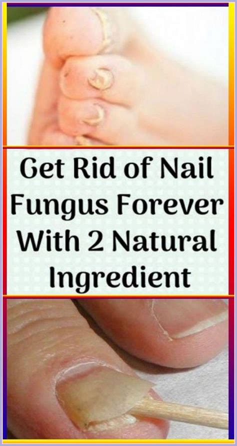 How to use tea tree oil for toenail fungus – Artofit