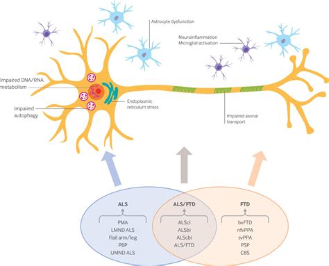 Als Physical Therapy