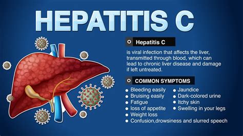 When do Hepatitis C Symptoms Appear? – NutritionFact.in