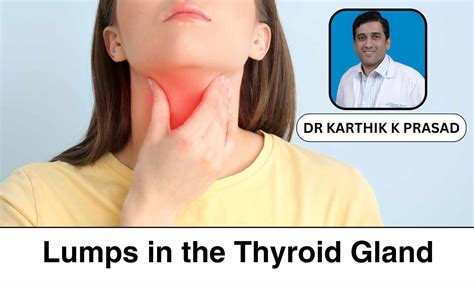 Identifying and Managing Thyroid Nodules: A Comprehensive Guide - Dr ...