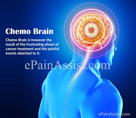 What Causes Chemo Brain or Chemo Fog and How is it Treated?
