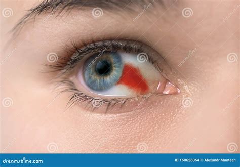 Blood Vessel Royalty-Free Stock Photo | CartoonDealer.com #73450995
