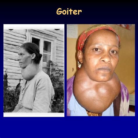 Image result for Thyroid Function Algorithm