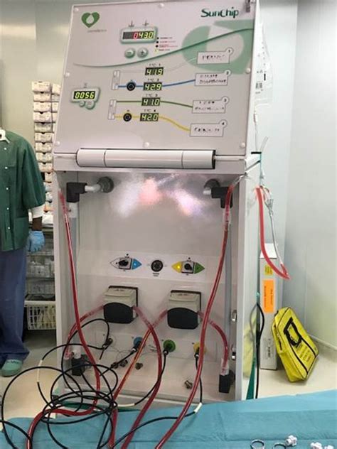 HIPEC Surgery | Central London Piles | London Colonoscopy | Colin Elton