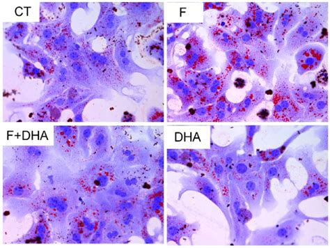 Docosahexaenoic Acid Ameliorates Fructose-Induced Hepatic Steatosis ...