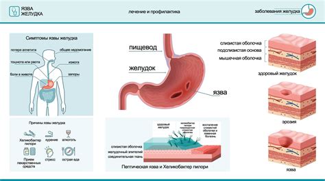 Кто-нибудь вылечил себе гастрит??? - страна мам