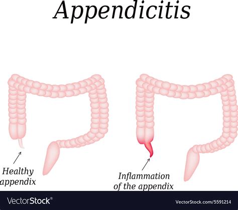 Image result for Appendix Example Website