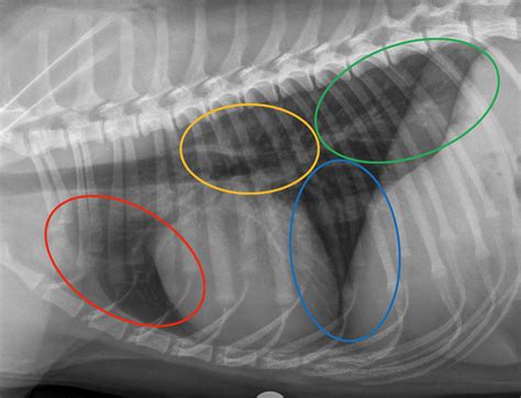 Topographical distribution and radiographic pattern of lung lesions in ...