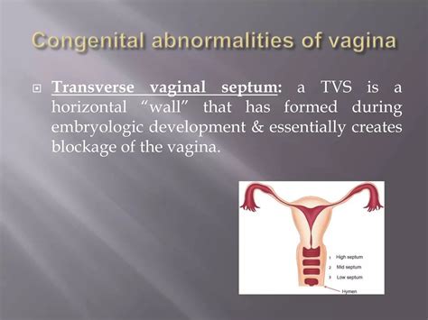 Image result for Female Reproductive System Disorders